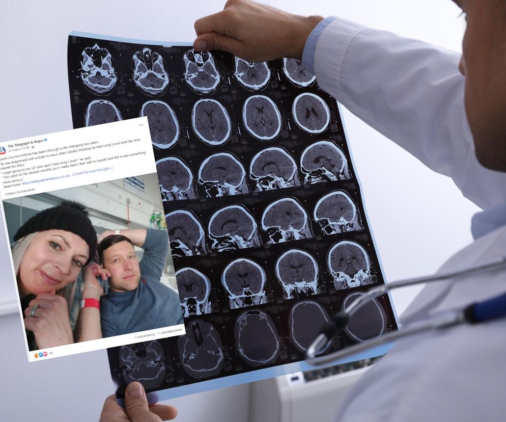 Guz w jego mózgu rósł 10 lat. Mrowienie i zmęczenie sygnalizowały problem