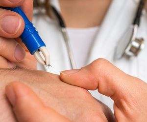 Odszkodowanie za ugryzienie kleszcza? To możliwe, ale pod pewnymi warunkami