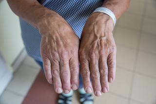 Boję się, że będę miała twarz giganta