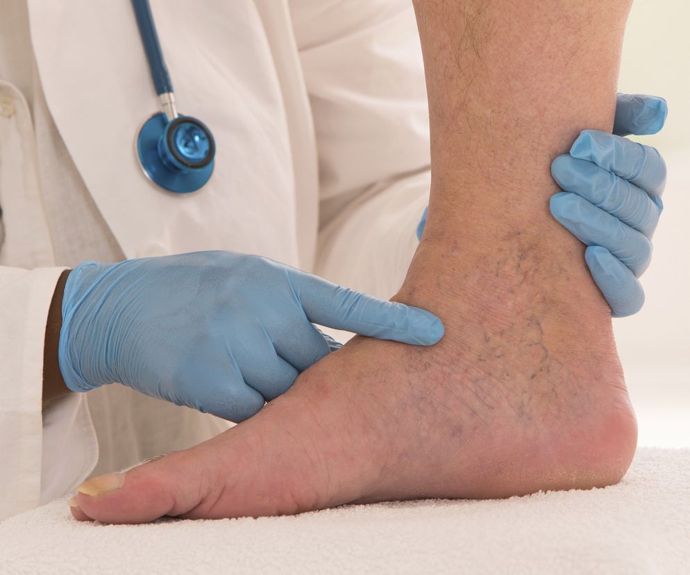 Chirurg naczyniowy: czym się zajmuje chirurgia naczyniowa?