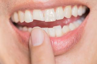 Sennik - zęby. Co oznacza sen o zębach?