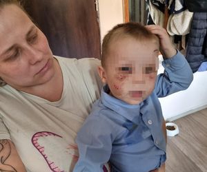 Pies pogryzł 3-latka na przystanku