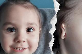 Kalinka Woźniak z Nowego Targu musi przejść operację rekonstrukcji ucha