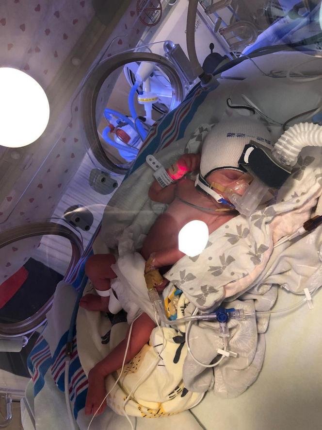 Apel o pomoc dla bliźniaków