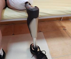Lekarze, którzy stworzyli najnowocześniejsza proteze dla motocyklisty z urwana nogą