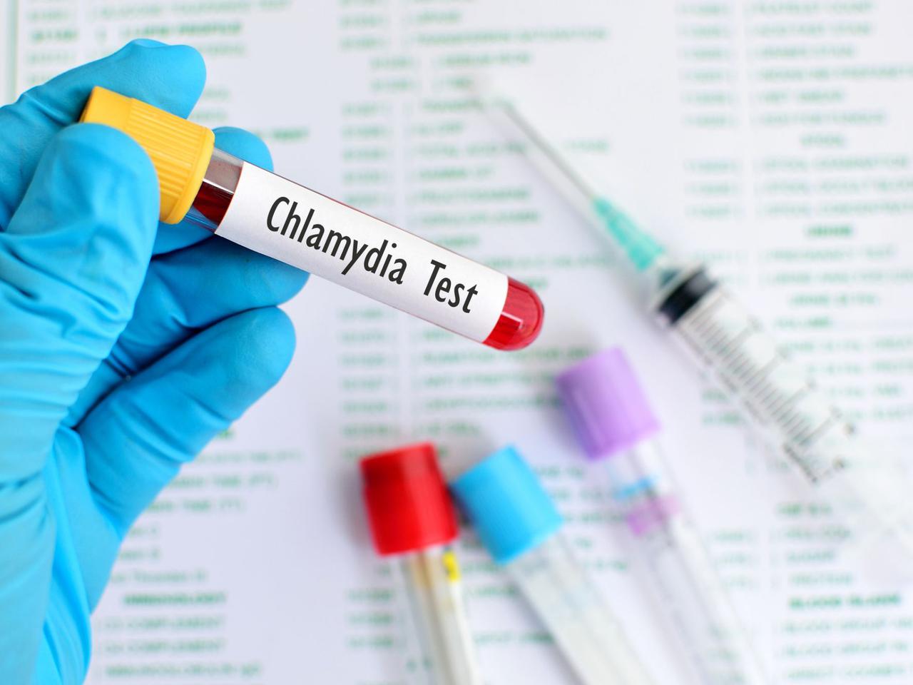 Chlamydioza. Jakie badania wykryją chlamydię?