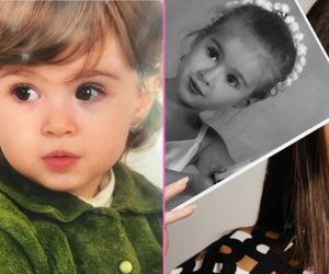  Plamka w oku miała być urazem porodowym. Mając 8 lat malowała się, by ukryć rosnące znamię