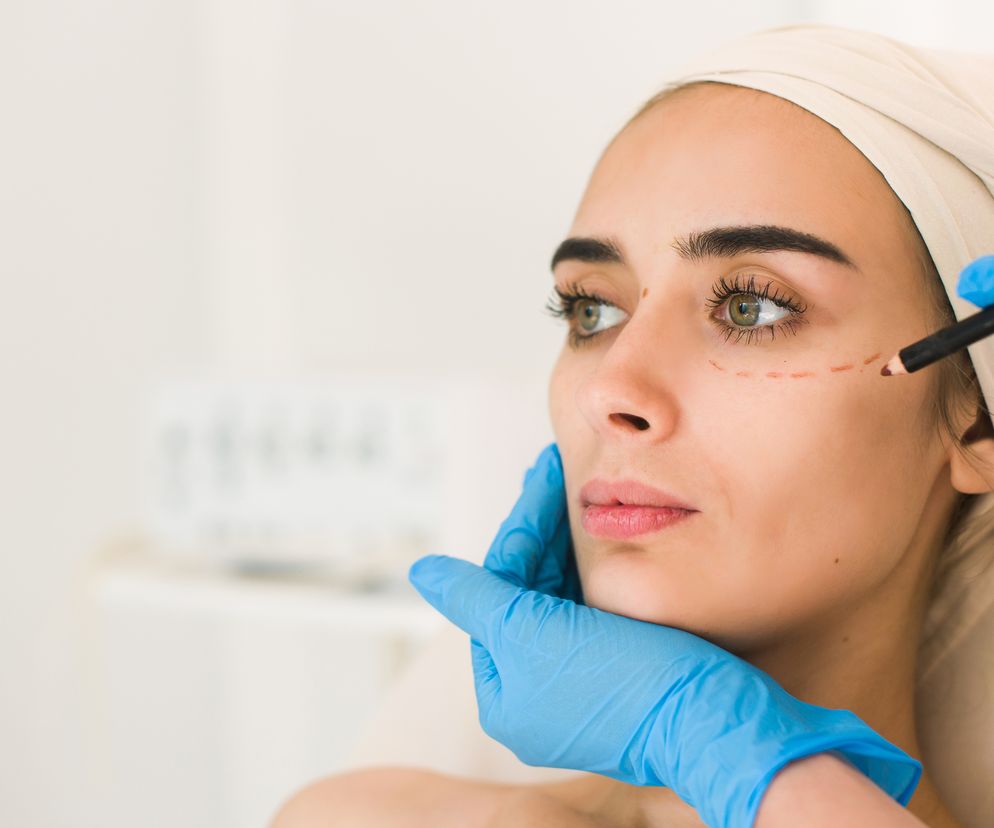 Blepharoplastyka (korekcja powiek) 