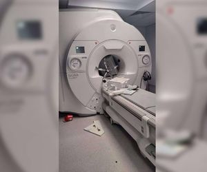 TYLKO U NAS: Kosztowny incydent w szpitalu na Podkarpaciu. Nowy rezonans wciągnął wózek zabiegowy 
