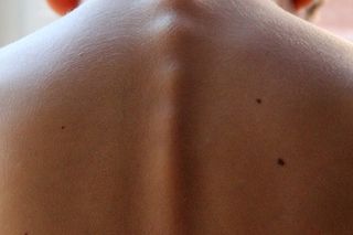 Prawdopodobieństwo, że Twoje dziecko ma wadę postawy, jest ogromne! Dlaczego?