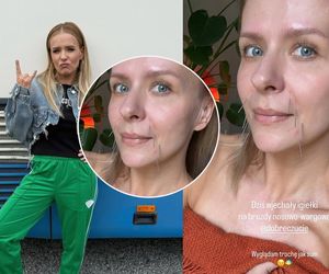 Aneta Zając cała w igłach. Boli od samego patrzenia! Co ona sobie zrobiła?