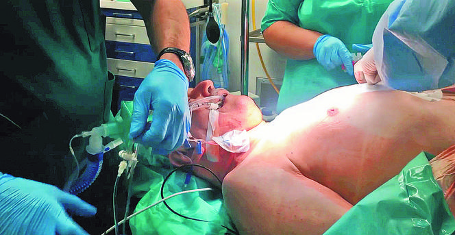 Sala operacyjna. Operacja wszczepienia by-passów na żywo