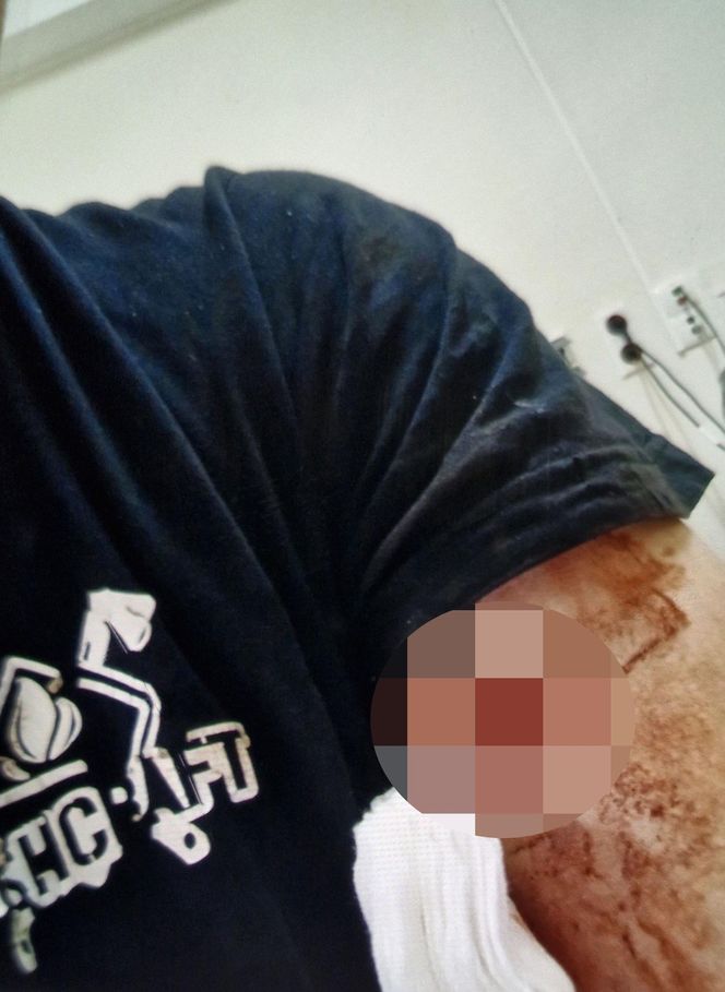 Tu mieszkał Kolumbijczyk, który zabił Polaka! 41-letni Grzegorz zginął od ciosów nożem