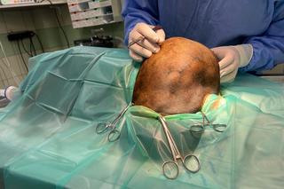 Weterynarze wycięli Zuzi gigantycznego guza