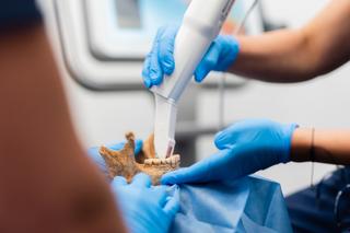 Dentyści z Katowic badają zęby wampirów z Gliwic