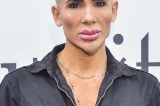 Michał Przybyłowicz czyli polski Ken. Nie do wiary, jak wyglądał przed operacjami!