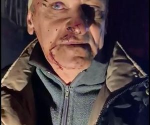 Krwawy dzień na Ukrainie. Rosjanie zbombardowali kolejne miasto, jest wiele ofiar