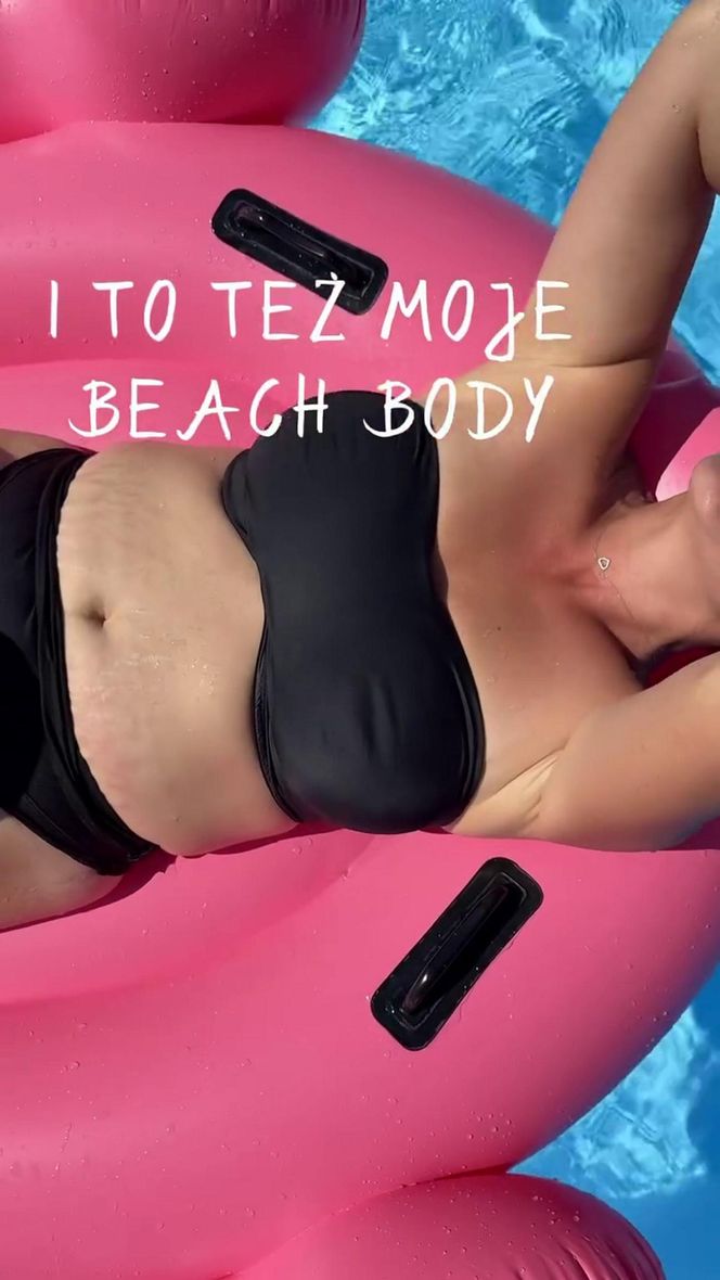 Dorota Szelągowska nie wstydzi się rozstępów