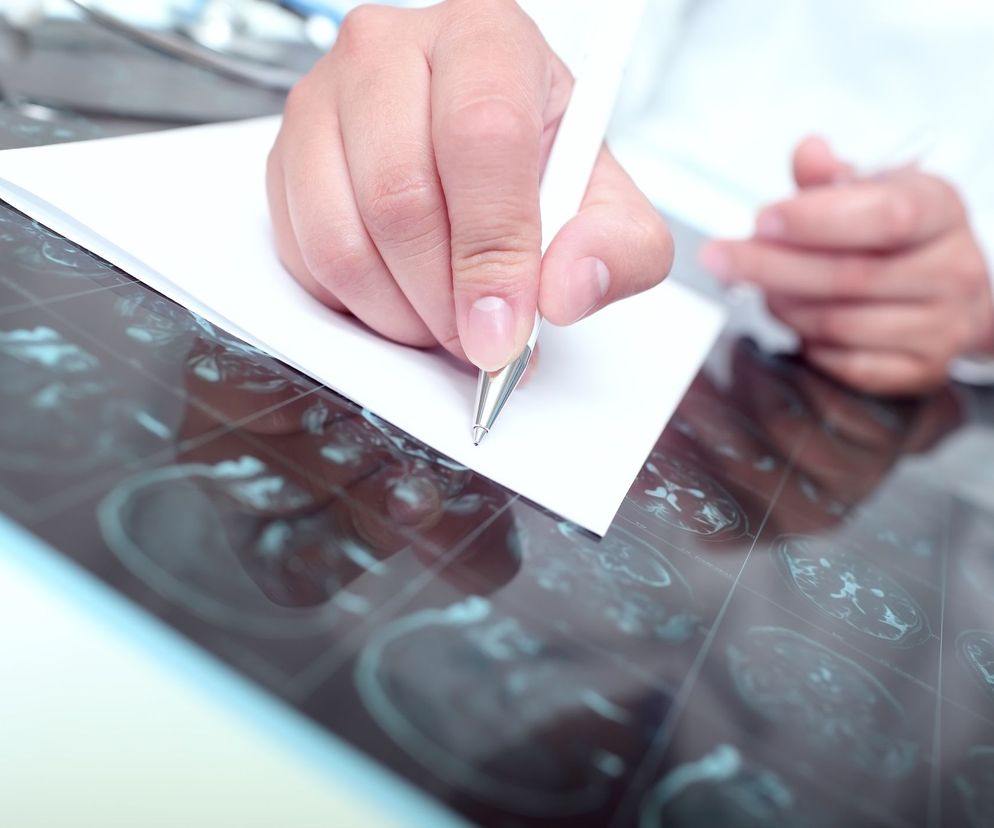 Psychogenne napady rzekomopadaczkowe to dowód na to, że nie każde zaburzenie, które prezentuje się jak napad padaczkowy, w rzeczywistości jest padaczką.