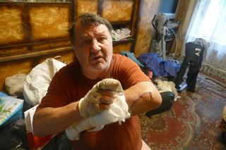 Sąsiad chciał mnie zaszlachtować maczetą