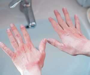 Choroby skóry? Czasem pomóc może tylko psychiatra. Jak u przedszkolaka noszącego gryzące rajstopy