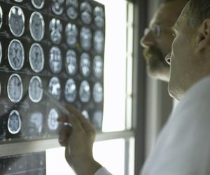 Glejak: objawy i leczenie guza mózgu