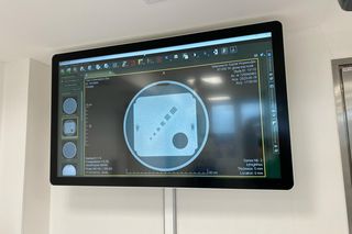 Oddział wewnętrzny oraz oddział otolaryngologii i onkologii laryngologicznej w siedleckim szpitalu wojewódzkim już otwarte