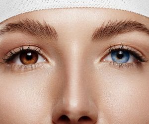 HETEROCHROMIA czyli różnobarwne tęczówki oka