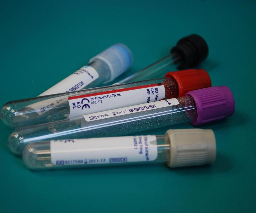 Kalisz. Ruszają bezpłatne i anonimowe badania w kierunku HIV