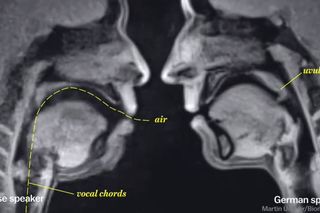 Tak wygląda człowiek OD ŚRODKA, kiedy uprawia SEKS! [NIESAMOWITE WIDEO]