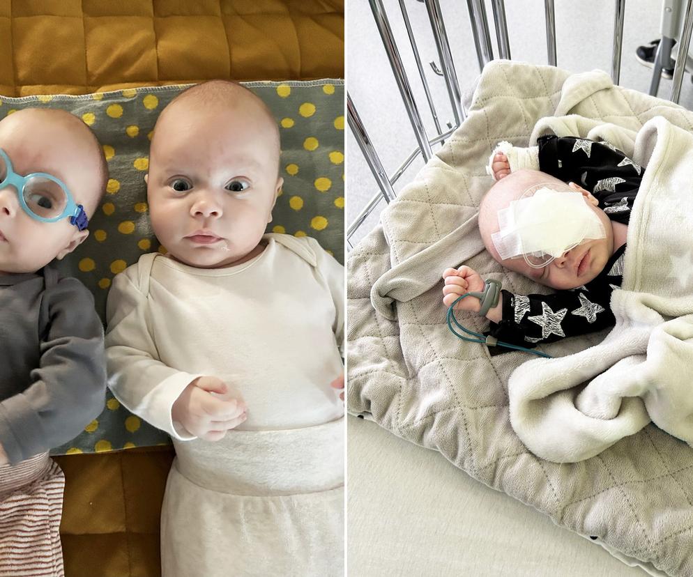 Apel o pomoc dla bliźniaków