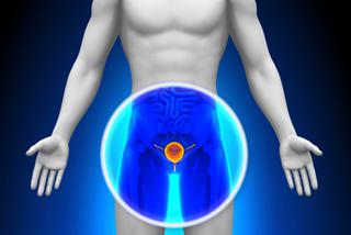 Rak prostaty – wzrasta zachorowalność i umieralność na raka stercza w Polsce