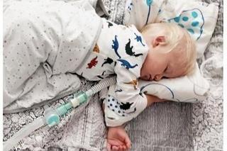 Oluś nie może oddychać gdy śpi. Synek stołecznych policjantów pilnie potrzebuje pomocy