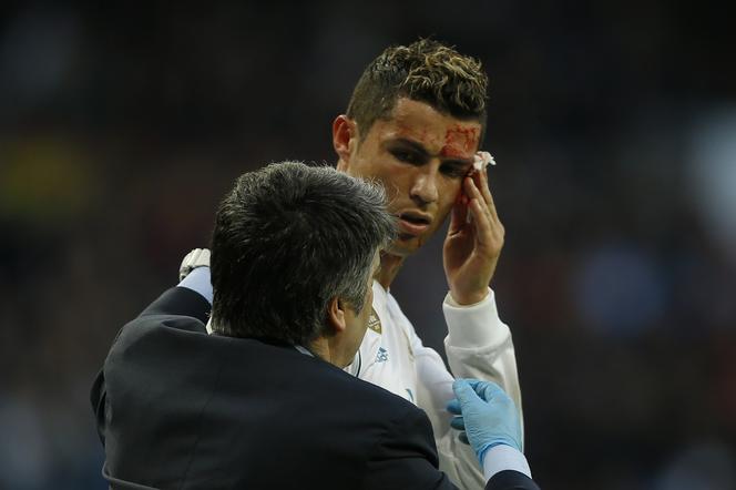 Zakrwawiony Cristiano Ronaldo