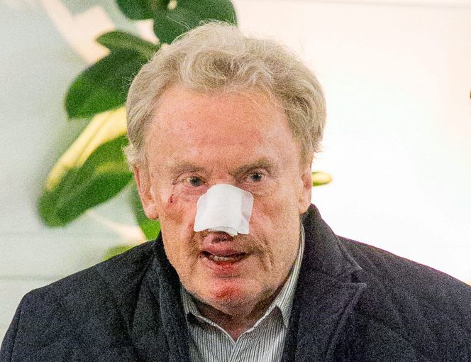 Daniel Olbrychski miał wypadek