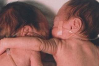 BLIŹNIĘTA: noworodek przytulił w inkubatorze umierającą siostrę. I wydarzył się cud [FILM]