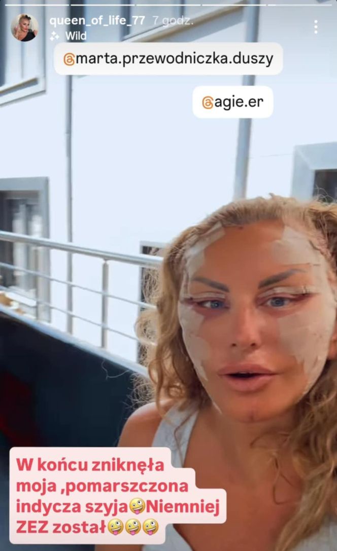 Dagmara Kaźmierska po operacji twarzy