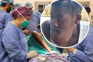Lekarze z Olsztyna wykonają rekonstrukcję uzębienia Cristiny z Angoli. Potrzebna ogromna kwota