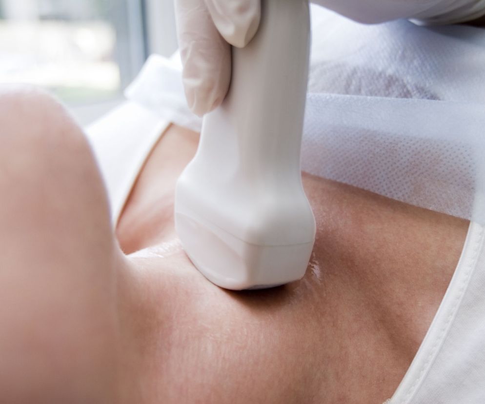 Wole zamostkowe to powiększona tarczyca, która swoim południowym biegunem sięga aż za mostek.