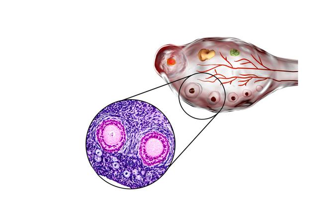Rezerwa jajnikowa – twoja pula komórek jajowych