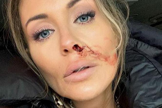 Małgorzata Rozenek-Majdan