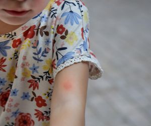 Co ugryzło twoje dziecko? Rozpoznaj ślad po ukąszeniu i działaj szybko