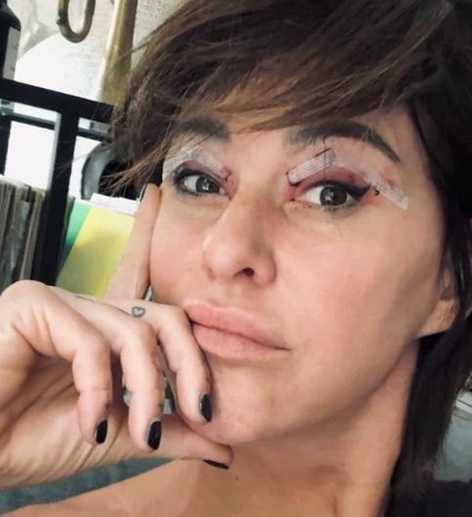 Katarzyna Skowrońska przeszła operację plastyczną