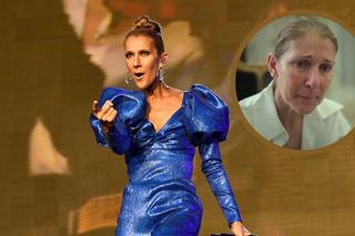 Gdyby nie Céline Dion, nikt by nie słyszał o tej chorobie. Czym jest zespół sztywnego człowieka? 