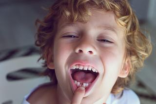 Co jeśli nie ma zawiązków zębów stałych? Hipodoncja to nie wyrok