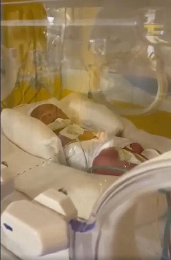 Urodziła dziewięcioraczki! Lekarze przegapili dwoje dzieci