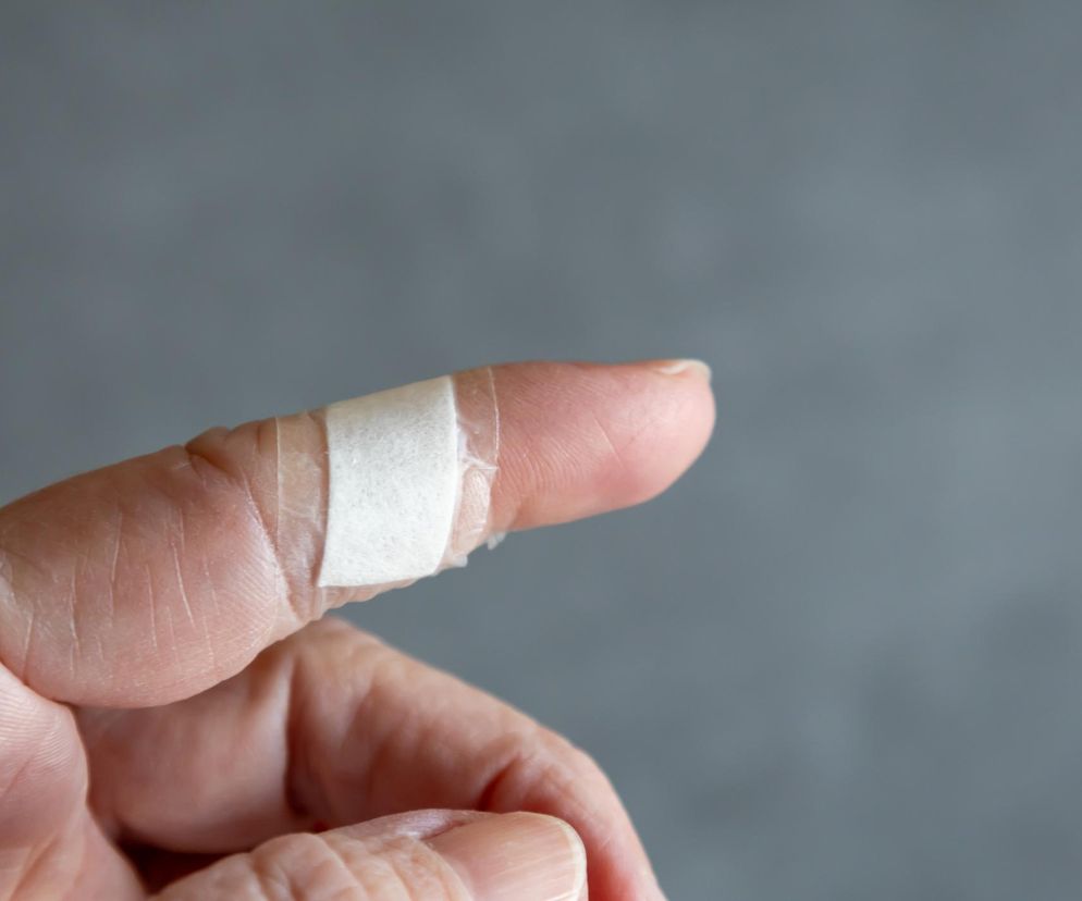 Gencjana farbuje, woda utleniona szczypie, oktenidyną straszą. To co na zranienia?