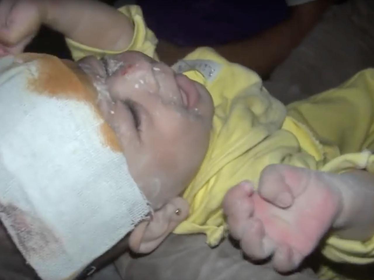 NIEMOWLAK WYCIĄGNIĘTY SPOD GRUZÓW ALEPPO.