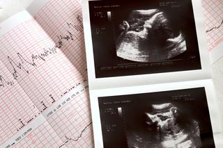 Czy w świetle nowych przepisów wykonywanie badań prenatalnych będzie jeszcze miało sens?