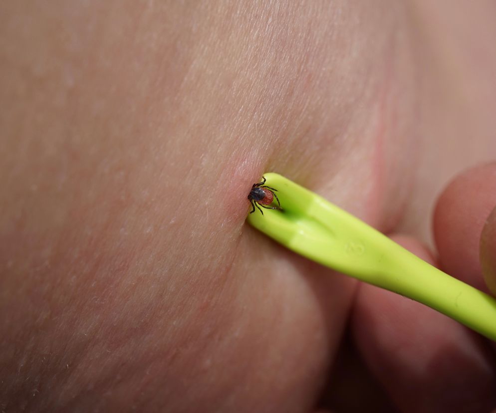 Wirus Alongshan dotarł do naszych sąsiadów. Zarażone kleszcze dotrą do Polski?